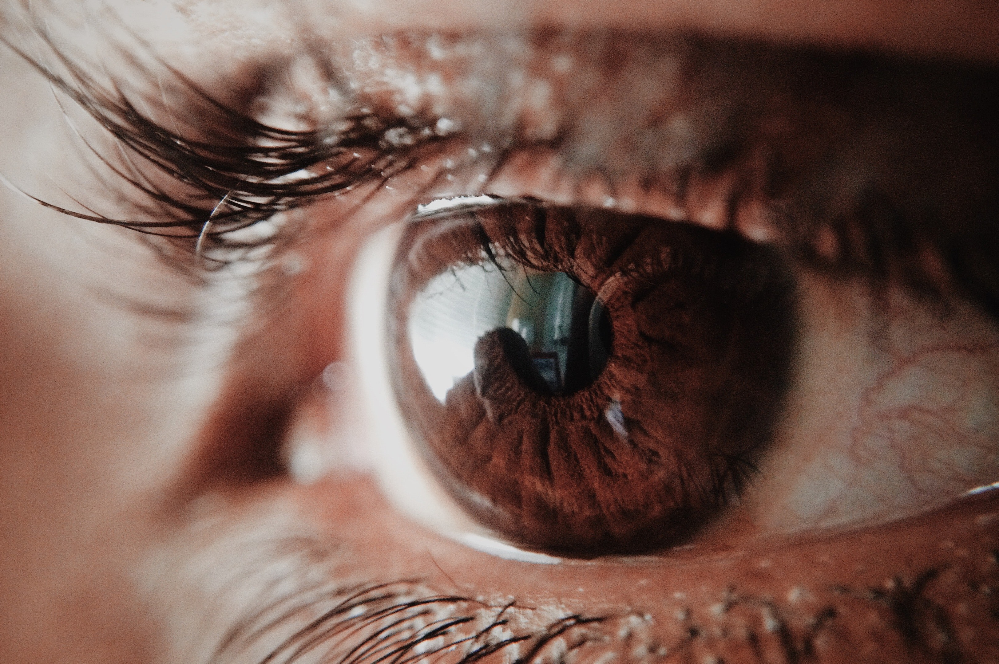 Sindrome dell’occhio secco: sintomi e rimedi